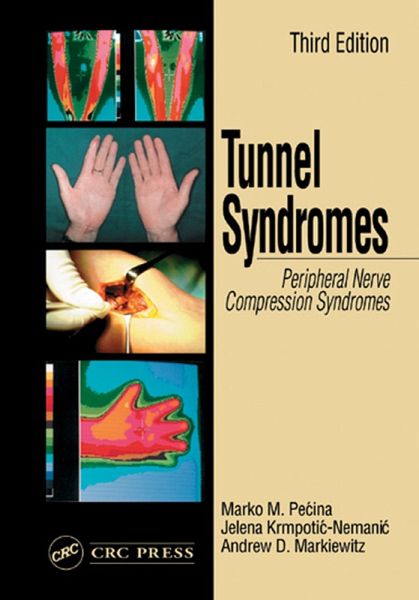 Tunnel Syndromes (eBook, PDF)
