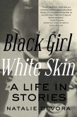 Black Girl White Skin (eBook, ePUB)