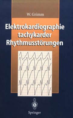 Elektrokardiographie tachykarder Rhythmusstörungen (eBook, PDF) - Grimm, W.