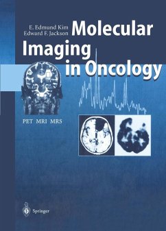 Molecular Imaging in Oncology (eBook, PDF) - Kim, E. Edmund; Jackson, Edward F.