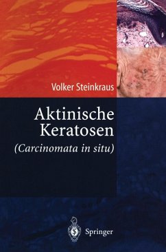 Aktinische Keratosen (Carcinomata in situ) (eBook, PDF) - Steinkraus, Volker