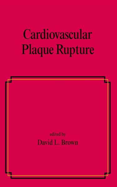 Cardiovascular Plaque Rupture (eBook, PDF)