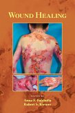 Wound Healing (eBook, PDF)