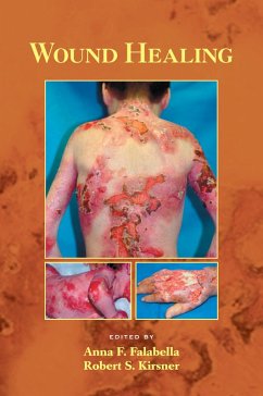 Cover Wound Healing (eBook, PDF)