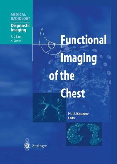 Functional Imaging of the Chest (eBook, PDF)