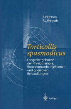 Torticollis spasmodicus (eBook, PDF) - Peterson, E.; Erbguth, F. J.