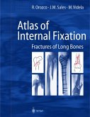 Atlas of Internal Fixation (eBook, PDF)
