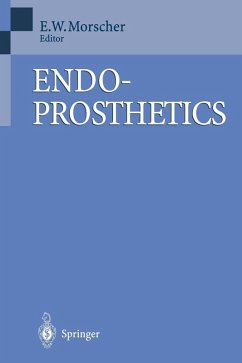 Endoprosthetics (eBook, PDF)