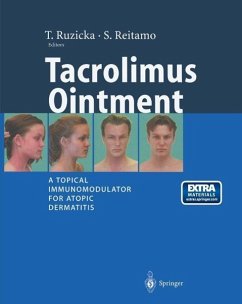 Cover Tacrolimus Ointment (eBook, PDF)