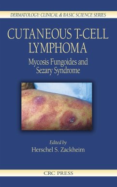Cover Cutaneous T-Cell Lymphoma (eBook, PDF)