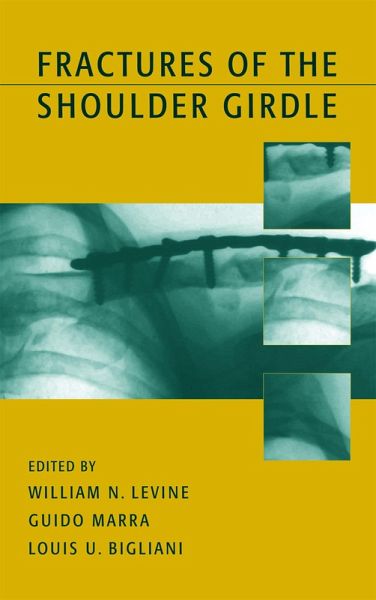 Fractures of the Shoulder Girdle (eBook, PDF) Fractures of the Shoulder Girdle (eBook, PDF)