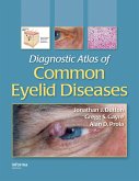 Diagnostic Atlas of Common Eyelid Diseases (eBook, PDF)