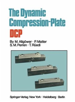 The Dynamic Compression Plate DCP (eBook, PDF) - Allgöwer, Martin; Matter, P.; Perren, S. M.; Rüedi, T.