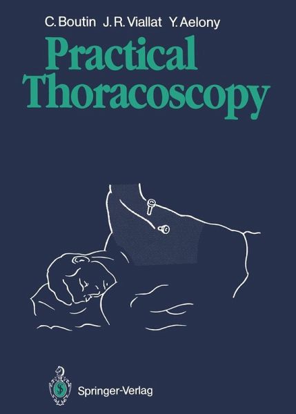 Practical Thoracoscopy (eBook, PDF)