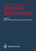 Shoulder Replacement (eBook, PDF)