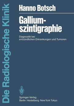 Galliumszintigraphie (eBook, PDF) Cover Galliumszintigraphie (eBook, PDF)