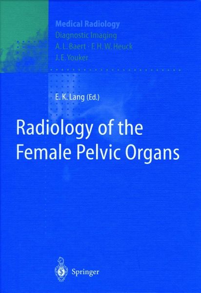 Radiology of the Female Pelvic Organs (eBook, PDF) Radiology of the Female Pelvic Organs (eBook, PDF)