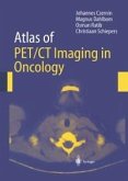 Atlas of PET/CT Imaging in Oncology (eBook, PDF)