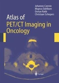 Atlas of PET/CT Imaging in Oncology (eBook, PDF) - Czernin, Johannes; Dahlbom, Magnus; Ratib, O.; Schiepers, Christiaan