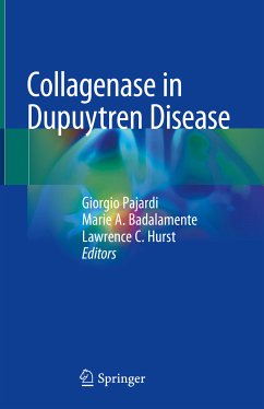 Collagenase in Dupuytren Disease (eBook, PDF)