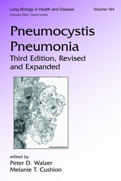 Cover Pneumocystis Pneumonia (eBook, PDF)