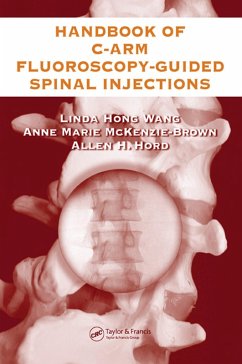 The Handbook of C-Arm Fluoroscopy-Guided Spinal Injections (eBook, PDF) - Wang, Linda Hong; McKenzie-Brown, Anne Marie; Hord, Allen