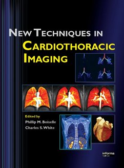 New Techniques in Cardiothoracic Imaging (eBook, PDF)