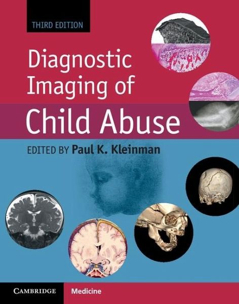Diagnostic Imaging of Child Abuse (eBook, ePUB) Diagnostic Imaging of Child Abuse (eBook, ePUB)