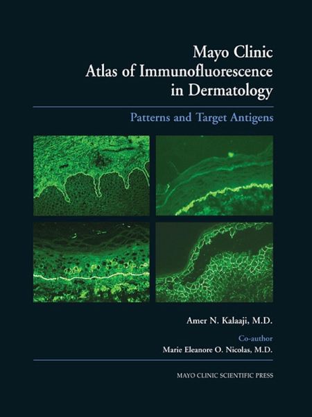 Mayo Clinic Atlas of Immunofluorescence in Dermatology (eBook, PDF)