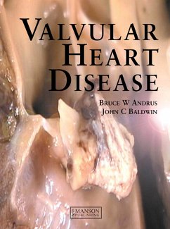 Valvular Heart Disease (eBook, PDF) - Andrus, Bruce; Baldwin, John