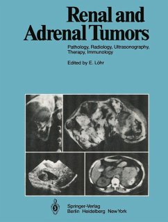 Renal and Adrenal Tumors (eBook, PDF) - Ackerman, R.; Dominick, H. C.; Fiedler, V.; Fuchs, W. A.; Georgi, M.; Goerttler, U.; Goldberg, M.; Günther, R.; Havers, W.; Heckmann, R.; Holfeld, H.; Jeanmart, L.; Kaude, J. V.; Leder, L. D.; Löhr, E.; Marberger, M.; Marchal, G.; Mellin, P.; Moss, A.; Olsson, O.; Osteaux, M.; Richter, H. J.; Scherer, E.; Stambolis, C.; Strötges, M. W.; Swart, B.; Wilms, Guido; Bachmann, D.; Baert, A.; Behrendt, H.; Beyer, D.; Bischoff, W.; Boijsen, E.