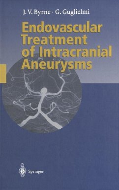 Endovascular Treatment of Intracranial Aneurysms (eBook, PDF) - Byrne, James; Guglielmi, Guido