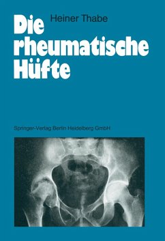 Die rheumatische Hüfte (eBook, PDF) - Thabe, Heiner