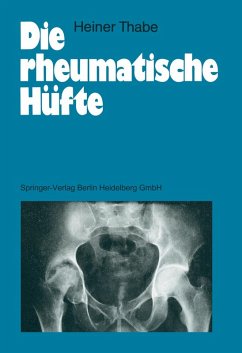 Cover Die rheumatische Hüfte (eBook, PDF)
