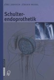 Schulterendoprothetik (eBook, PDF)