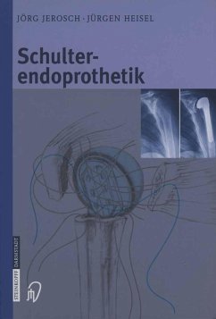Schulterendoprothetik (eBook, PDF) - Jerosch, Jörg; Heisel, Jürgen