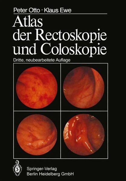 Atlas der Rectoskopie und Coloskopie (eBook, PDF) Atlas der Rectoskopie und Coloskopie (eBook, PDF)