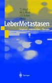 LeberMetastasen (eBook, PDF)