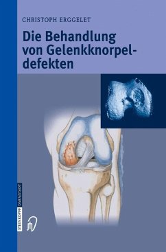 Die Behandlung von Gelenkknorpeldefekten (eBook, PDF) - Erggelet, Christoph