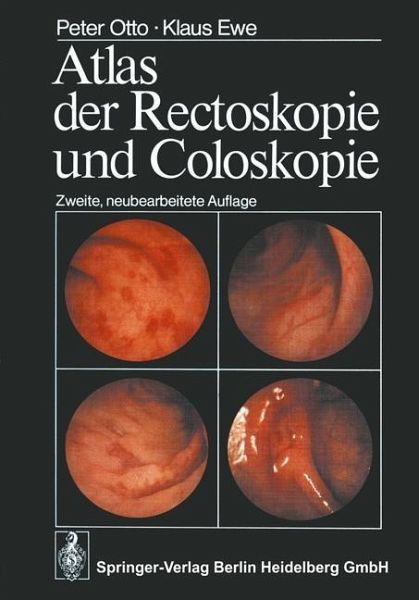 Atlas der Rectoskopie und Coloskopie (eBook, PDF) Atlas der Rectoskopie und Coloskopie (eBook, PDF)