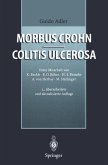 Morbus Crohn - Colitis ulcerosa (eBook, PDF)