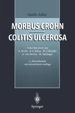 Morbus Crohn - Colitis ulcerosa (eBook, PDF) - Adler, Guido