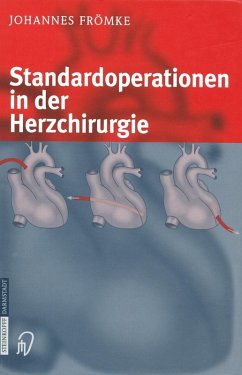 Standardoperationen in der Herzchirurgie (eBook, PDF) - Frömke, Johannes