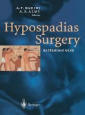 Hypospadias Surgery (eBook, PDF)