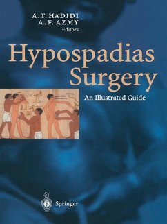 Cover Hypospadias Surgery (eBook, PDF)