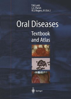 Cover Oral Diseases (eBook, PDF)