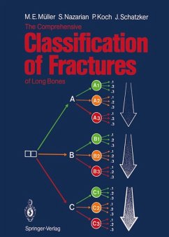 The Comprehensive Classification of Fractures of Long Bones (eBook, PDF) - Müller, Maurice E.; Nazarian, Serge; Koch, Peter; Schatzker, Joseph