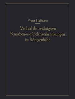 Verlauf der wichtigsten Knochen- und Gelenkerkrankungen im Röntgenbilde (eBook, PDF) - Hoffmann, Victor