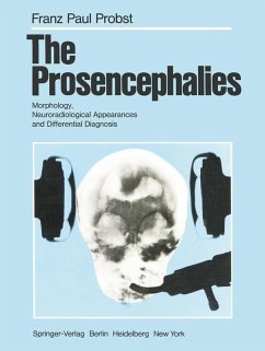 Cover The Prosencephalies (eBook, PDF)