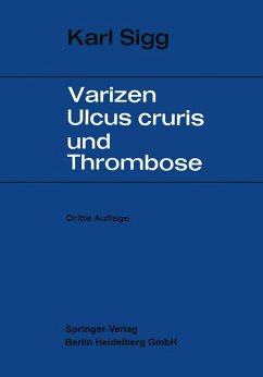 Cover Varicen - Ulcus Cruris und Thrombose (eBook, PDF)